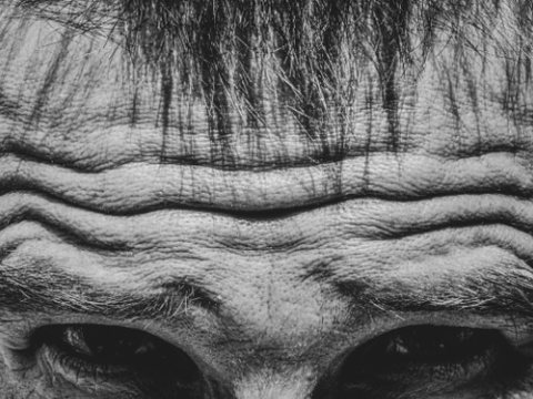 Forehead lines