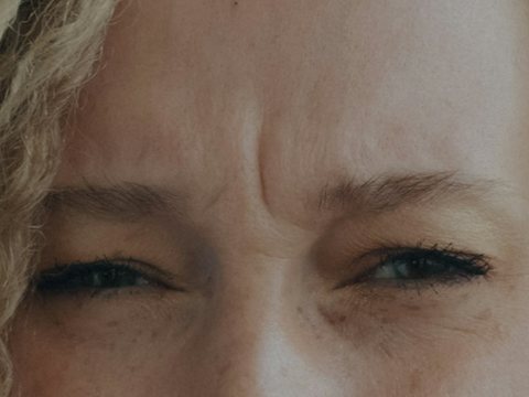 Frown lines